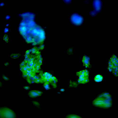 hidrogel_1 hidrogel_1